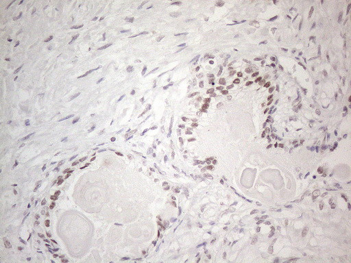 MMP2 Antibody in Immunohistochemistry (Paraffin) (IHC (P))