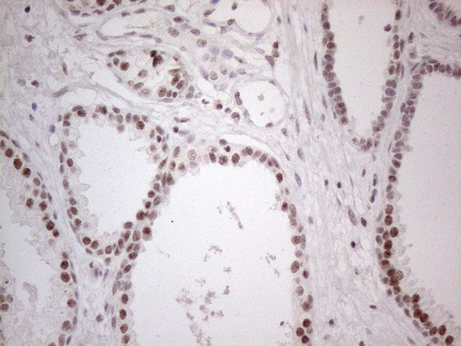 MMP2 Antibody in Immunohistochemistry (Paraffin) (IHC (P))