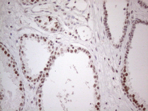 MMP2 Antibody in Immunohistochemistry (Paraffin) (IHC (P))