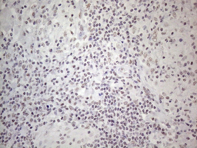 MMP2 Antibody in Immunohistochemistry (Paraffin) (IHC (P))