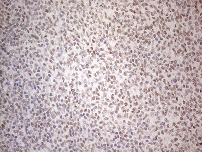 MMP2 Antibody in Immunohistochemistry (Paraffin) (IHC (P))