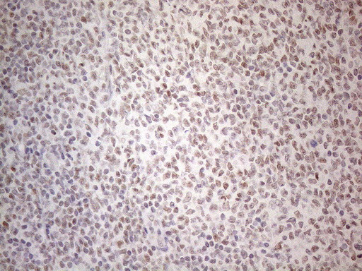 MMP2 Antibody in Immunohistochemistry (Paraffin) (IHC (P))