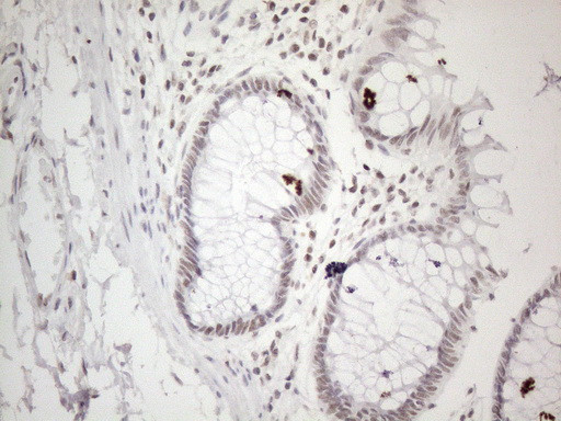 MMP2 Antibody in Immunohistochemistry (Paraffin) (IHC (P))