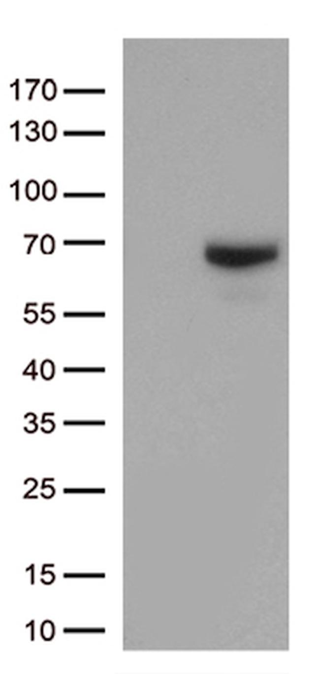 MMP2 Antibody in Western Blot (WB)