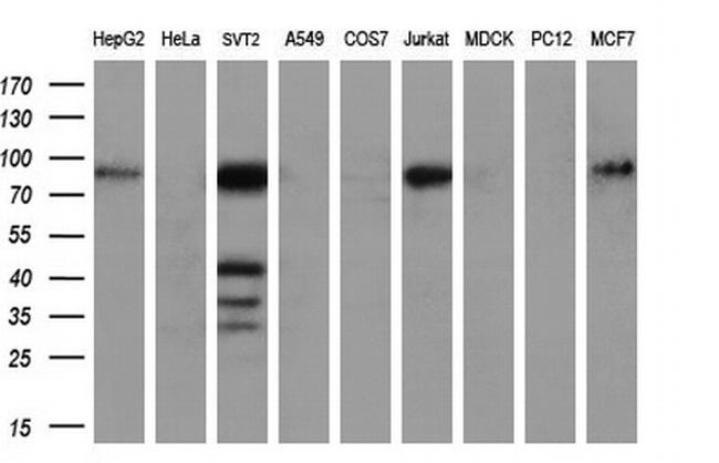 MMP2 Antibody in Western Blot (WB)