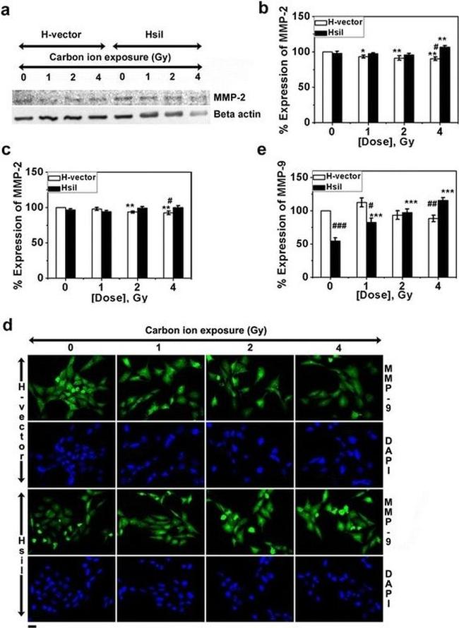 MMP2 Antibody in Western Blot (WB)