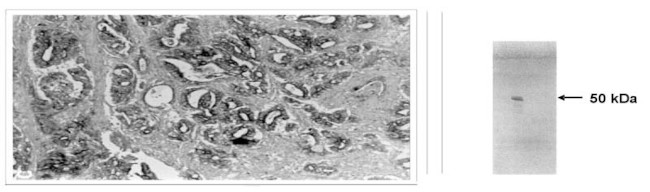 MMP3 Antibody in Immunohistochemistry (IHC)