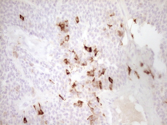 MMP3 Antibody in Immunohistochemistry (Paraffin) (IHC (P))