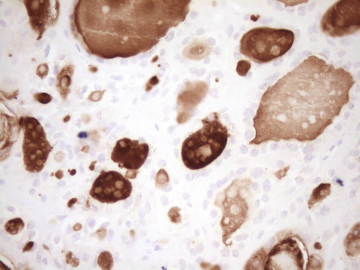 MMP3 Antibody in Immunohistochemistry (Paraffin) (IHC (P))