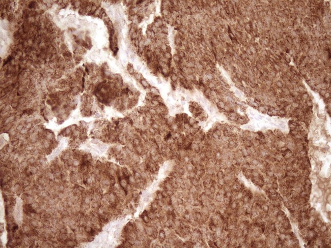 MMP3 Antibody in Immunohistochemistry (Paraffin) (IHC (P))