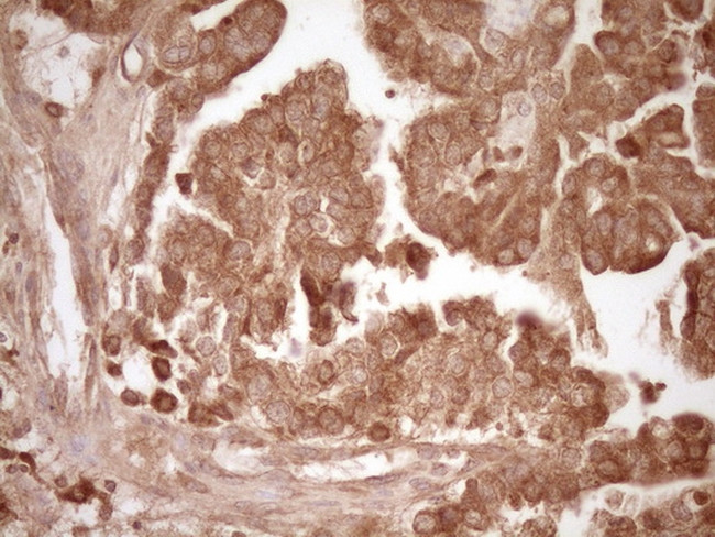 MMP3 Antibody in Immunohistochemistry (Paraffin) (IHC (P))