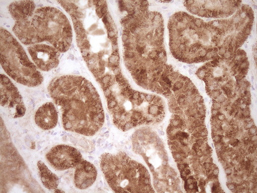 MMP3 Antibody in Immunohistochemistry (Paraffin) (IHC (P))