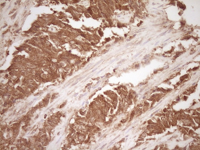 MMP3 Antibody in Immunohistochemistry (Paraffin) (IHC (P))