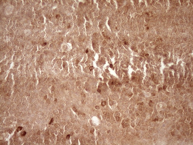 MMP3 Antibody in Immunohistochemistry (Paraffin) (IHC (P))