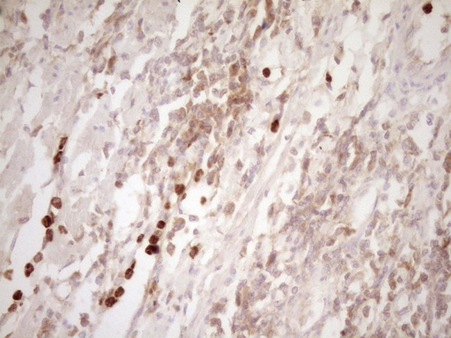 MMP3 Antibody in Immunohistochemistry (Paraffin) (IHC (P))