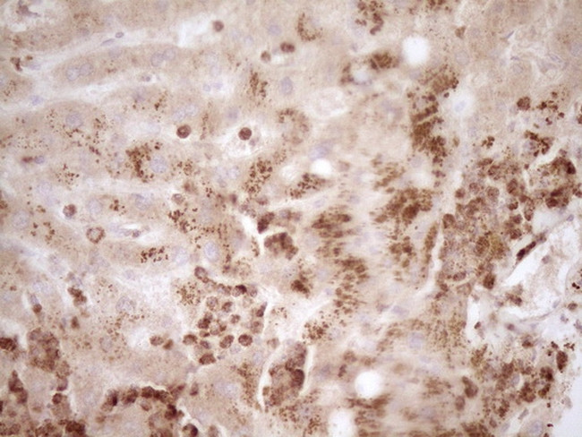 MMP3 Antibody in Immunohistochemistry (Paraffin) (IHC (P))