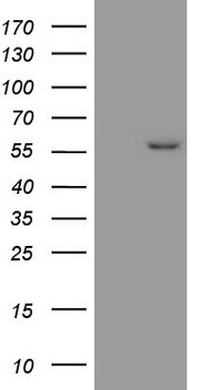 MMP3 Antibody in Western Blot (WB)