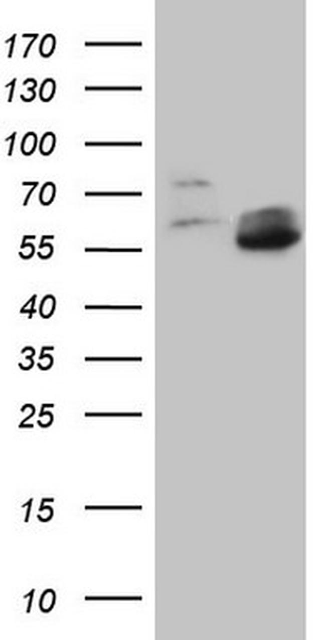 MMP3 Antibody in Western Blot (WB)