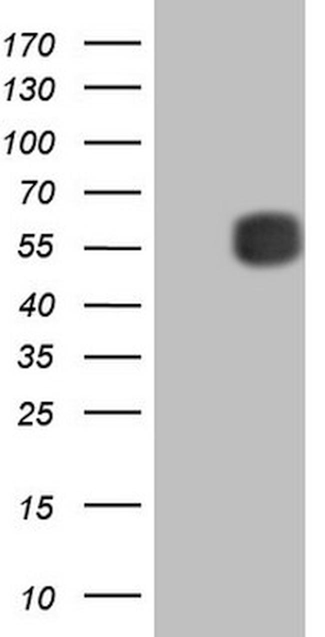 MMP3 Antibody in Western Blot (WB)