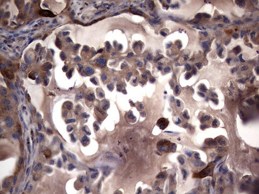 MMP7 Antibody in Immunohistochemistry (Paraffin) (IHC (P))