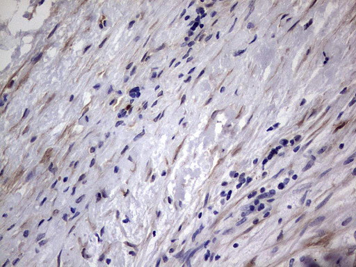 MMP7 Antibody in Immunohistochemistry (Paraffin) (IHC (P))