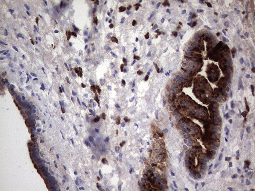 MMP7 Antibody in Immunohistochemistry (Paraffin) (IHC (P))