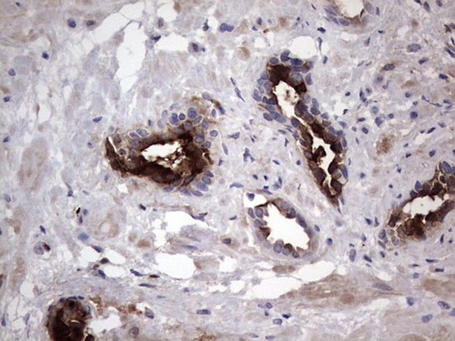 MMP7 Antibody in Immunohistochemistry (Paraffin) (IHC (P))