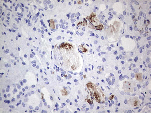 MMP7 Antibody in Immunohistochemistry (Paraffin) (IHC (P))