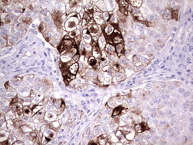 MMP7 Antibody in Immunohistochemistry (Paraffin) (IHC (P))