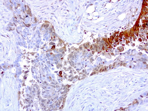 MMP7 Antibody in Immunohistochemistry (Paraffin) (IHC (P))