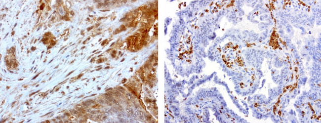 MMP7 Antibody in Immunohistochemistry (Paraffin) (IHC (P))