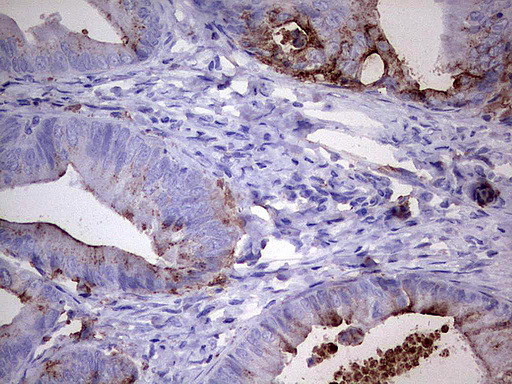 MMP7 Antibody in Immunohistochemistry (Paraffin) (IHC (P))