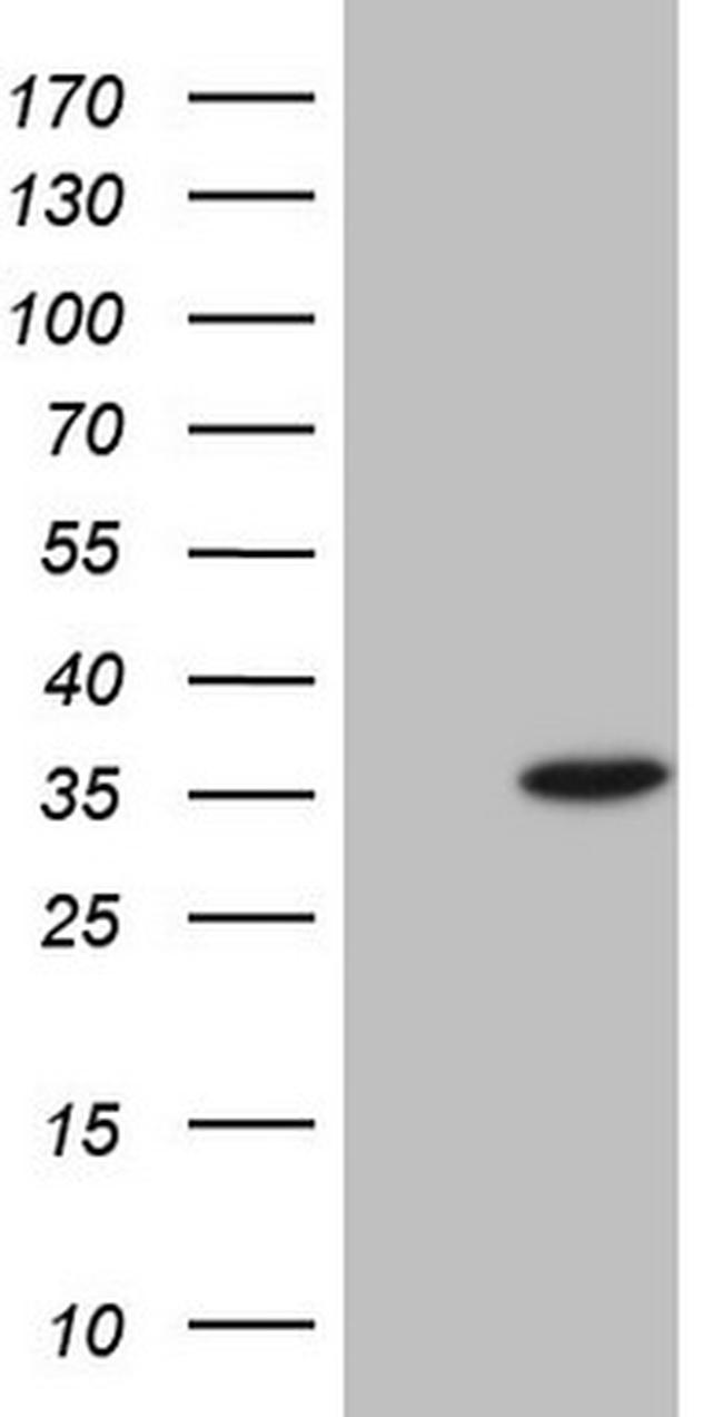 MMP7 Antibody in Western Blot (WB)