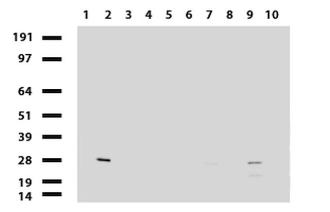 MMP7 Antibody in Western Blot (WB)