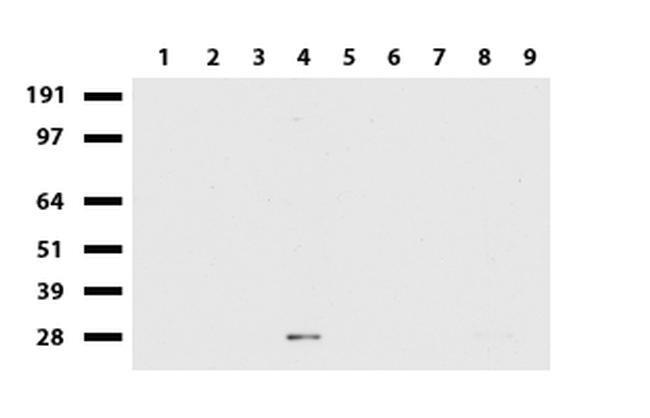 MMP7 Antibody in Western Blot (WB)