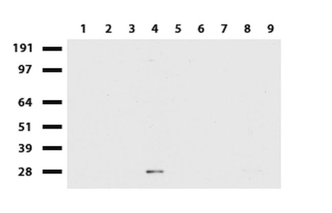 MMP7 Antibody in Western Blot (WB)