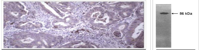 MMP9 Antibody in Immunohistochemistry (Paraffin) (IHC (P))