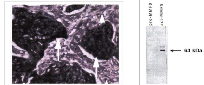 MMP9 Antibody in Immunohistochemistry (Paraffin) (IHC (P))