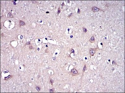 MMP9 Antibody in Immunohistochemistry (Paraffin) (IHC (P))