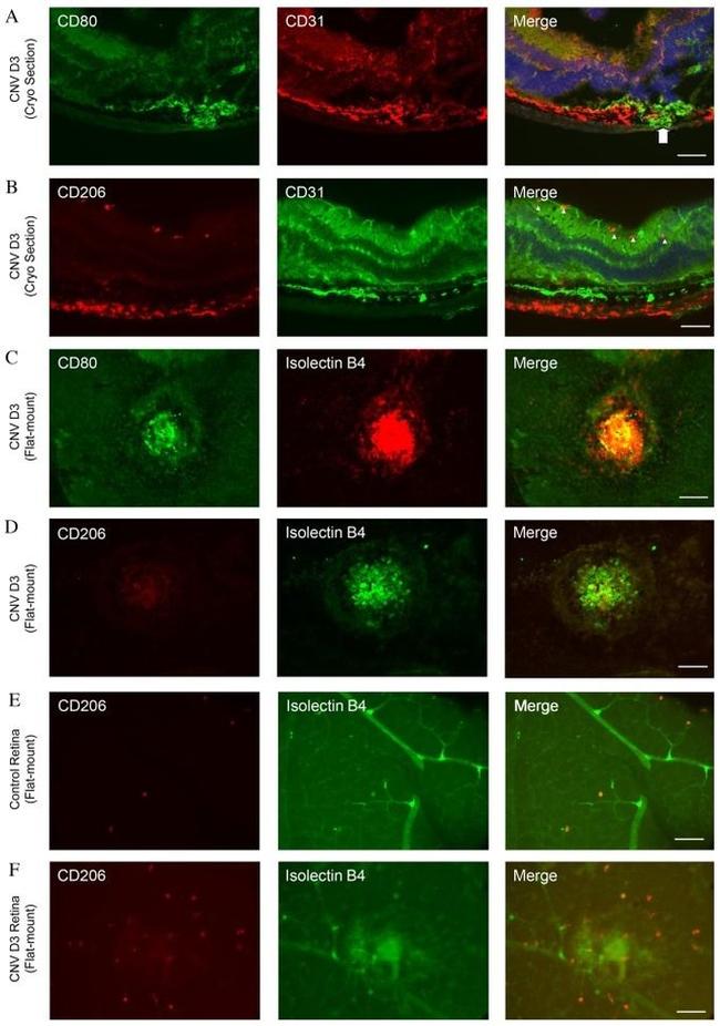 CD80 (B7-1) Antibody in Immunohistochemistry (IHC)