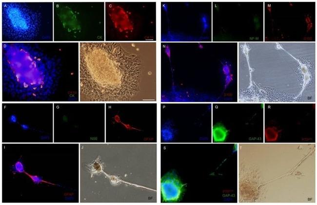 Cytokeratin Pan Type I/II Antibody in Immunocytochemistry (ICC/IF)