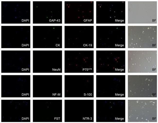 Cytokeratin Pan Type I/II Antibody in Immunocytochemistry (ICC/IF)