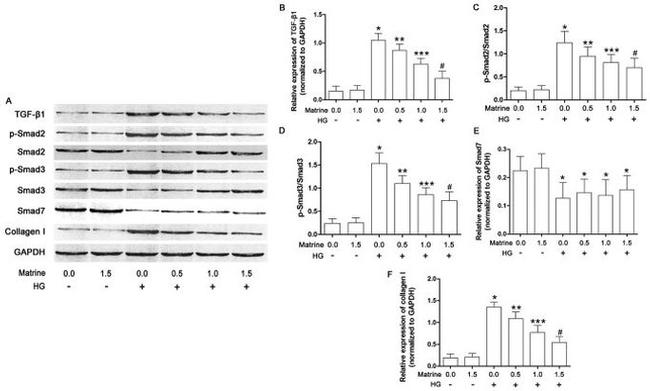 SMAD7 Antibody in Western Blot (WB)