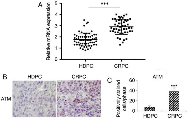 Phospho-ATM (Ser1981) Antibody in Immunohistochemistry (Paraffin) (IHC (P))