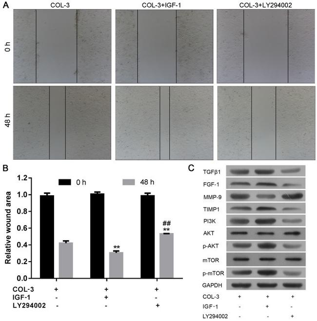 AKT Pan Antibody in Western Blot (WB)