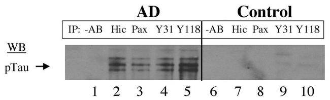 Phospho-Tau (Ser202, Thr205) Antibody in Western Blot (WB)