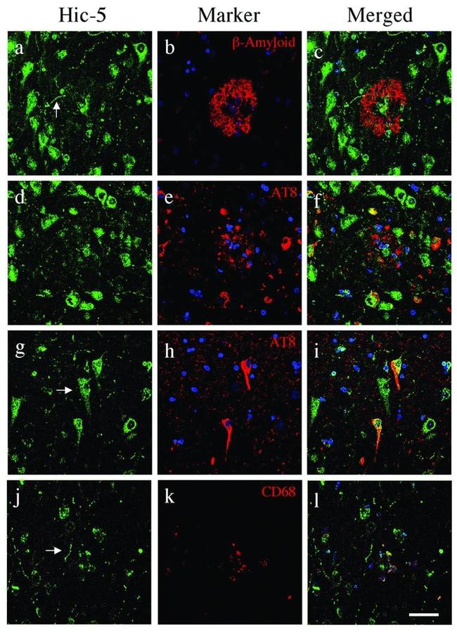 Phospho-Tau (Ser202, Thr205) Antibody in Immunohistochemistry (IHC)