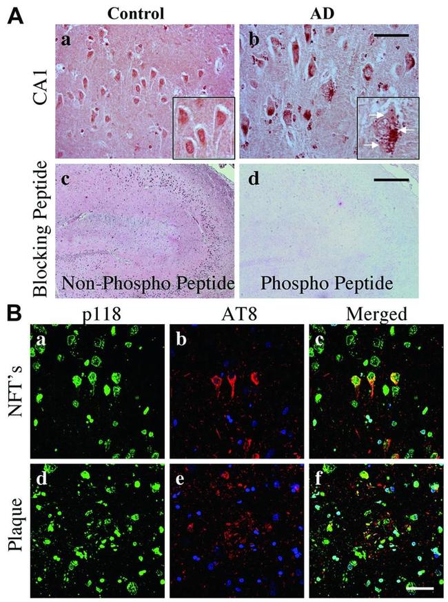 Phospho-Tau (Ser202, Thr205) Antibody in Immunohistochemistry (IHC)