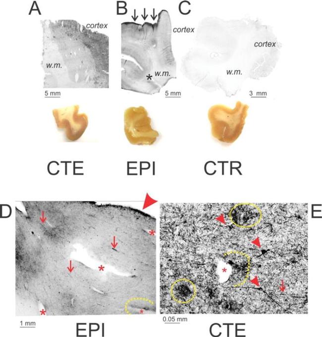 Phospho-Tau (Ser202, Thr205) Antibody in Immunohistochemistry (IHC)