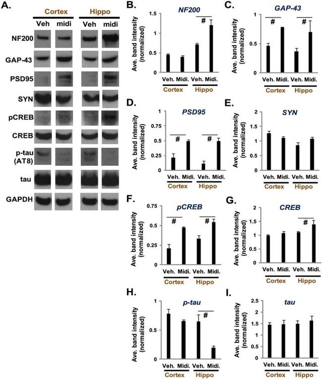 Phospho-Tau (Ser202, Thr205) Antibody in Western Blot (WB)